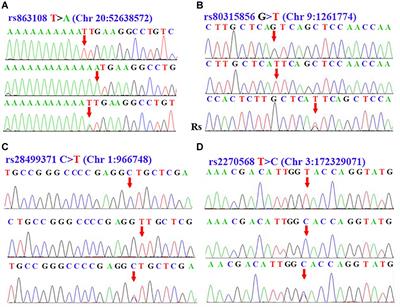 Sporadic Parkinson’s Disease Potential Risk Loci Identified in Han Ancestry of Chinese Mainland